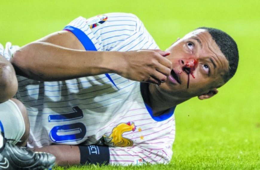 Euro 2024 – France : La blessure de Mbappé, gros nuage dans le ciel bleu