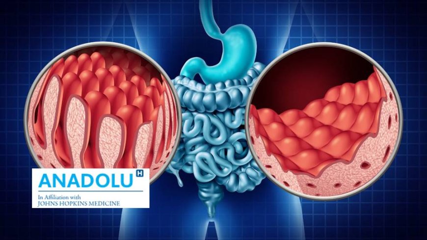 La maladie cœliaque expliquée : causes, symptômes, traitement et prévention !